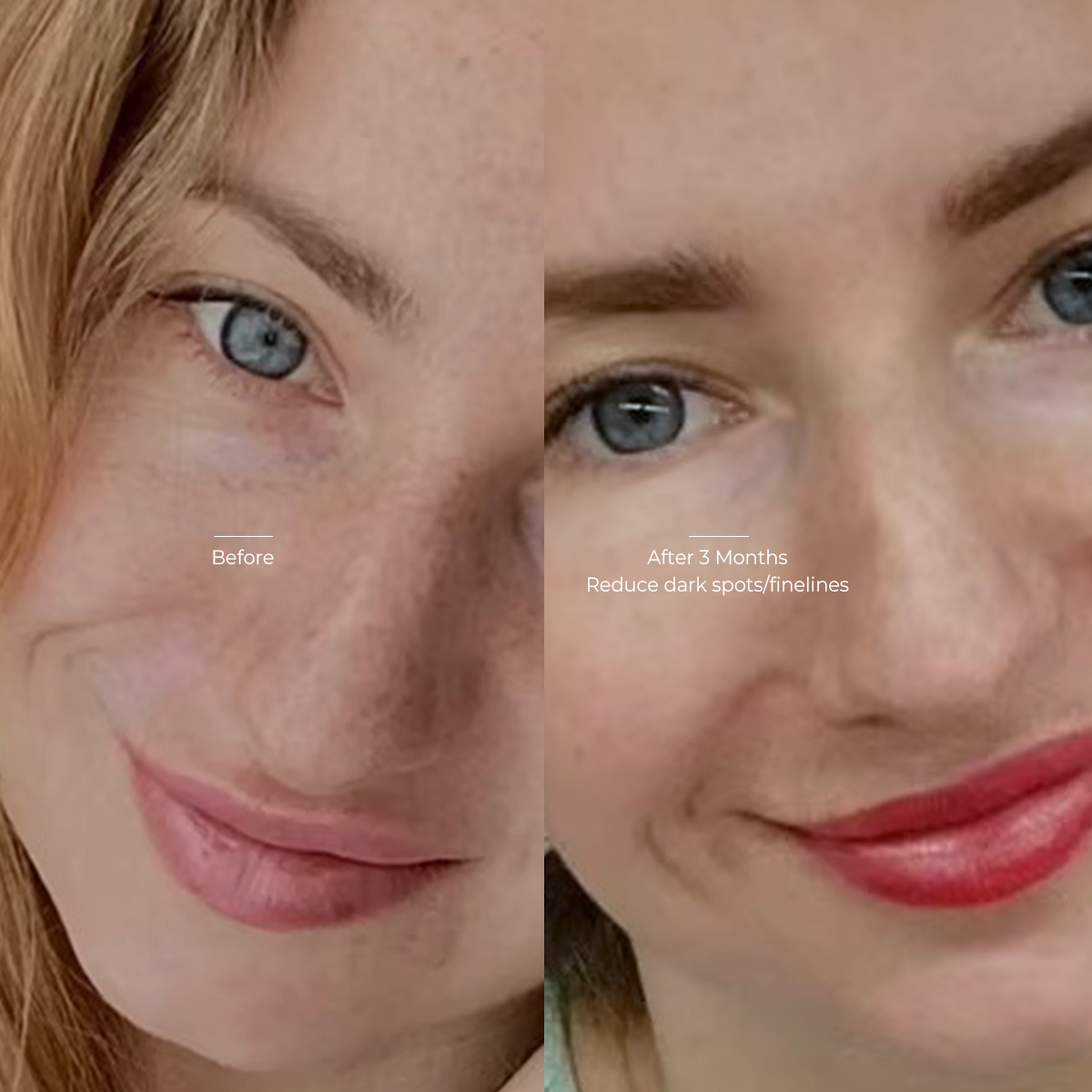 Minimize Finelines & Improve skin texture