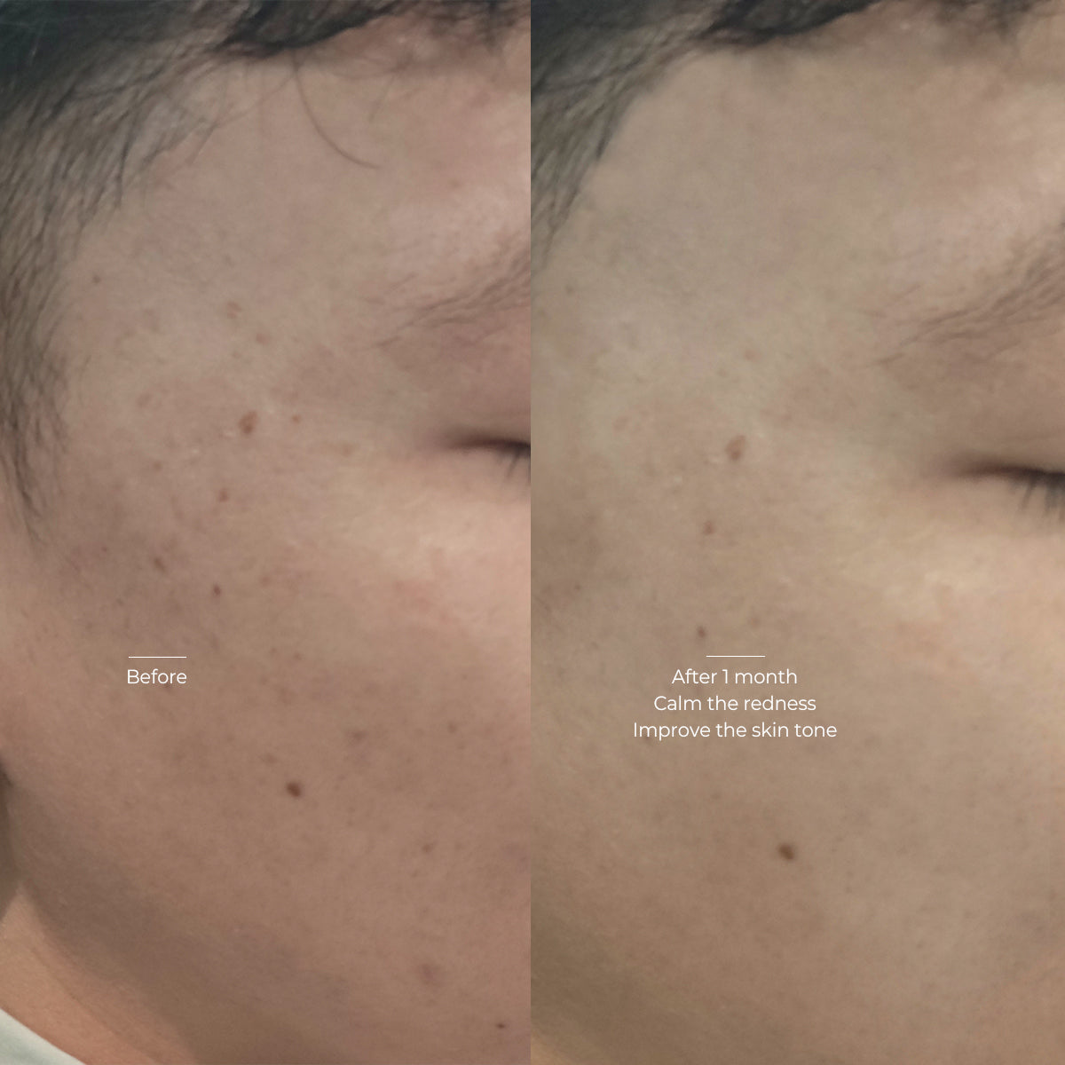 Calm skin redness