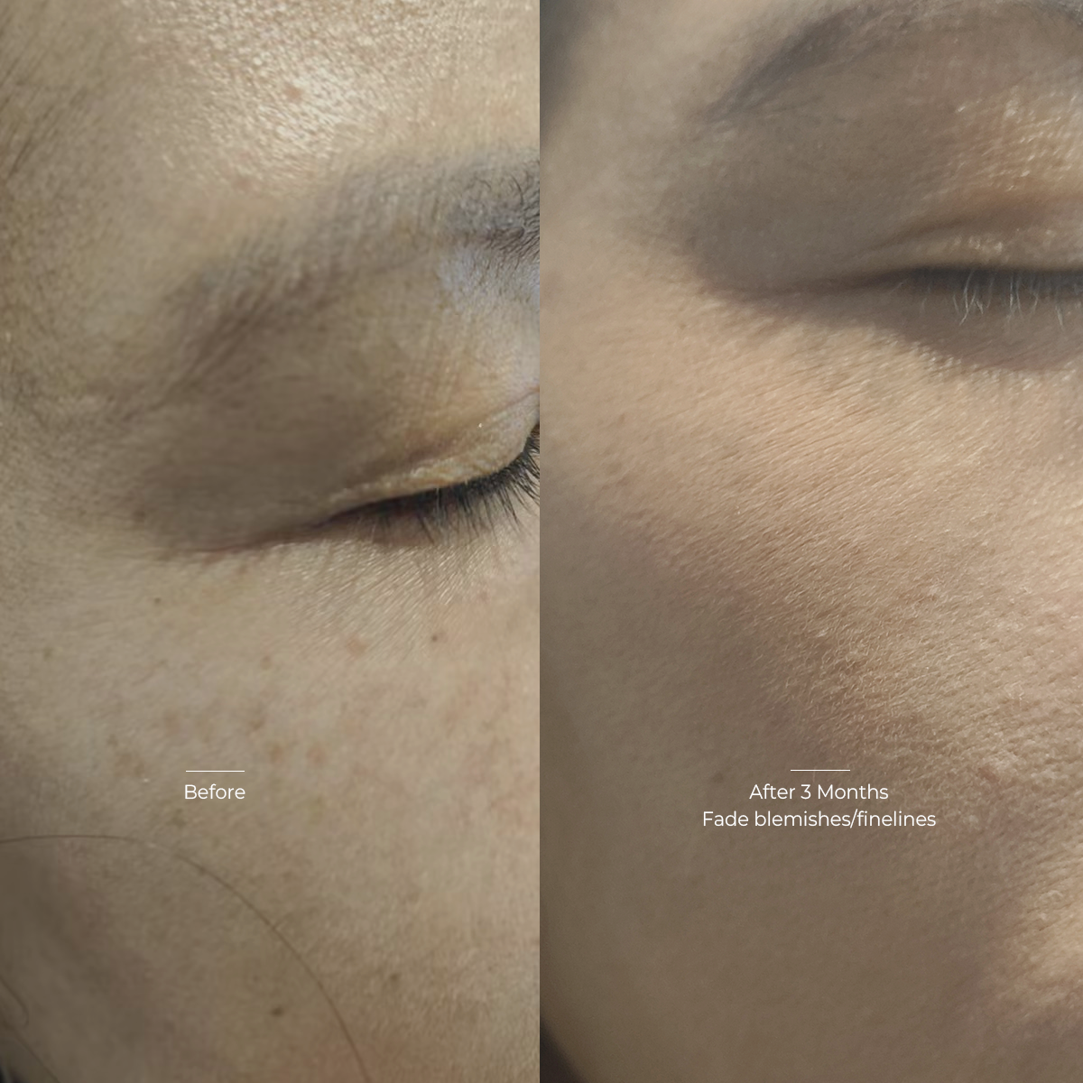 Faded Finelines & Blemishes